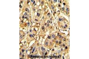 Immunohistochemistry (IHC) image for anti-Secreted Frizzled-Related Protein 5 (SFRP5) antibody (ABIN3002916)