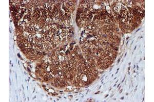 Image no. 6 for anti-Chromosome 1 Open Reading Frame 50 (C1ORF50) antibody (ABIN1497033)