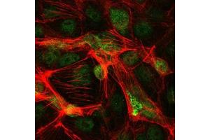 Immunofluorescence analysis of PC-2 cells using c-Jun mouse mAb (green).