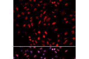 Immunofluorescence analysis of U2OS cells using POLD1 Polyclonal Antibody (POLD1 anticorps)