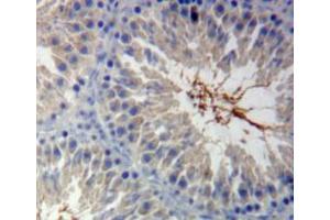Used in DAB staining on fromalin fixed paraffin-embedded testis tissue (Calmodulin 1 anticorps  (AA 1-149))