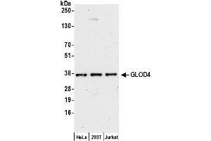 anti-Glyoxalase Domain Containing 4 (GLOD4) (AA 100-150) antibody