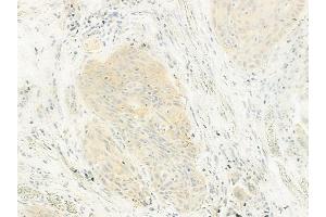 anti-Nicotinamide Nucleotide Transhydrogenase (NNT) (C-Term) antibody