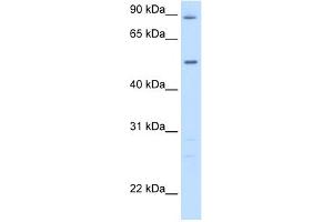 WB Suggested Anti-GPT Antibody Titration:  5.