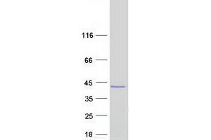 Validation with Western Blot