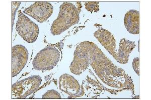 IHC analysis of BubR1/BUB1B using anti-BubR1/BUB1B antibody (ABIN7600962). (BUB1B anticorps  (AA 26-448))
