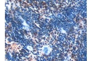 Detection of PLS3 in Mouse Spleen Tissue using Polyclonal Antibody to Plastin 3 (PLS3) (Plastin 3 anticorps  (AA 5-251))
