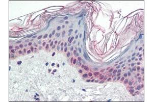 Human Skin (formalin-fixed, paraffin-embedded) stained with PARP2at 2. (PARP2 anticorps  (Internal Region))