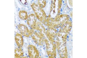 Immunohistochemistry of paraffin-embedded mouse kidney using  antibody (ABIN7265428) at dilution of 1:100 (40x lens).