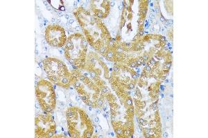 Immunohistochemistry of paraffin-embedded mouse kidney using  antibody (ABIN7265428) at dilution of 1:100 (40x lens). (ACOT2 anticorps  (AA 222-483))