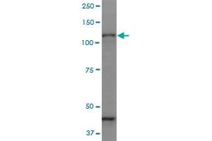PCDHGC3 monoclonal antibody (M07), clone 1C4. (Protocadherin gamma Subfamily C, 3 (PCDHGC3) (AA 1-934) anticorps)