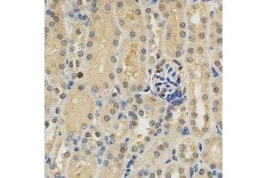 Immunohistochemistry of paraffin-embedded mouse kidney using PDGFRB antibody at dilution of 1:200 (x400 lens)