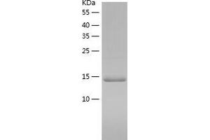 Western Blotting (WB) image for Spindle and Kinetochore-Associated Protein 2 (FAM33A) (AA 2-121) protein (His-IF2DI Tag) (ABIN7125192)