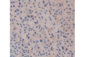 IHC-P analysis of Human Tissue, with DAB staining. (NPEPPS anticorps  (AA 584-793))