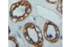 Used in DAB staining on fromalin fixed paraffin-embedded Kidney tissue (ADCY5 anticorps  (AA 167-385))