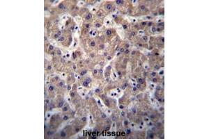 SULT1A3/SULT1A4 Antibody (N-term) immunohistochemistry analysis in formalin fixed and paraffin embedded human liver tissue followed by peroxidase conjugation of the secondary antibody and DAB staining. (SULT1A3/1A4 anticorps  (N-Term))