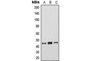 Western blot analysis of Cytokeratin 18 expression in HeLa (A), A431 (B), MCF7 (C) whole cell lysates. (Cytokeratin 18 anticorps  (C-Term))