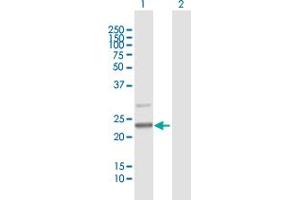 Western Blot analysis of C7orf30 expression in transfected 293T cell line by C7orf30 MaxPab polyclonal antibody. (C7orf30 anticorps  (AA 1-234))