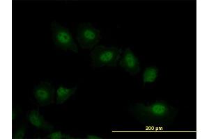 Immunofluorescence of monoclonal antibody to VRK2 on HeLa cell. (VRK2 anticorps  (AA 260-360))