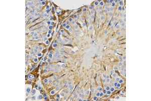 Immunohistochemistry of paraffin-embedded rat testis using PIWIL4 antibody (ABIN5971612) at dilution of 1/200 (40x lens).
