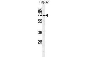 Western blot analysis of ARSI Antibody (C-term) in HepG2 cell line lysates (35µg/lane). (Arylsulfatase I anticorps  (C-Term))