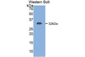 Western blot analysis of the recombinant protein. (ADCY7 anticorps  (AA 806-1052))