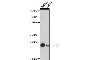 Western blot analysis of extracts of various cell lines, using FGF21 Rabbit mAb (ABIN1680154, ABIN3018263, ABIN3018264 and ABIN7101589) at 1:1000 dilution. (FGF21 anticorps)