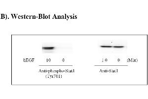 Image no. 4 for Signal Transducer and Activator of Transcription 1, 91kDa (STAT1) ELISA Kit (ABIN625231)