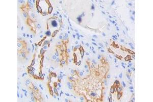 Used in DAB staining on fromalin fixed paraffin- embedded Kidney tissue (TBXAS1 anticorps  (AA 357-533))