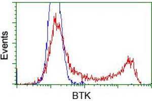 Image no. 5 for anti-Bruton Agammaglobulinemia tyrosine Kinase (BTK) antibody (ABIN1496972) (BTK anticorps)
