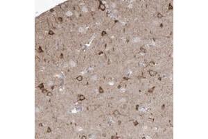 Immunohistochemical staining of human cerebral cortex with GTPBP8 polyclonal antibody  shows strong cytoplasmic positivity in neuronal cells. (GTPBP8 anticorps)