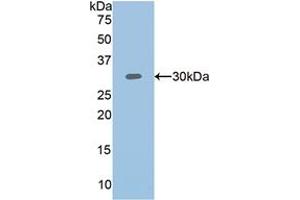 Western blot analysis of recombinant Human PLS3. (Plastin 3 anticorps  (AA 379-630))