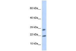 WB Suggested Anti-OCIAD2 Antibody Titration: 0. (OCIAD2 anticorps  (Middle Region))