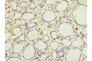 Immunohistochemistry of paraffin-embedded human thyroid tissue using ABIN7152056 at dilution of 1:100 (Ethanolamine Kinase 1 anticorps  (AA 90-258))