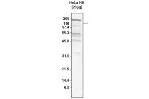 Western Blot of anti-SKI3 antibody Western Blot results of Rabbit anti-SKI3 antibody. (TTC37 anticorps)