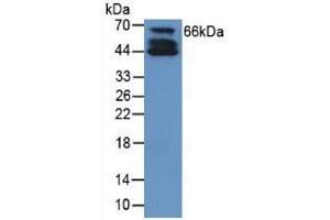 Rabbit Detection antibody from the kit in WB with Positive Control: Human cartilage tissue. (COL10 Kit CLIA)