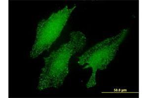 Immunofluorescence of monoclonal antibody to LMO3 on HeLa cell.