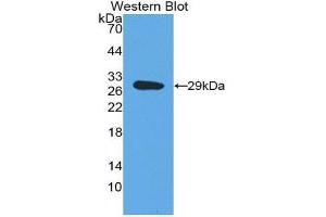 Western Blotting (WB) image for anti-Dopamine beta-Hydroxylase (Dopamine beta-Monooxygenase) (DBH) (AA 335-571) antibody (ABIN1858608) (DBH anticorps  (AA 335-571))