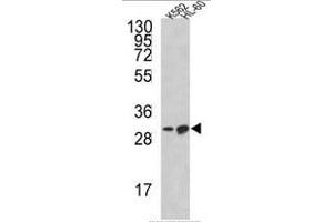 Western blot analysis of BCL2L11 Antibody (Center) in K562, HL-60 cell line lysates (35ug/lane).