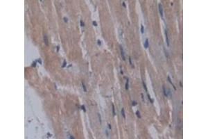 Used in DAB staining on fromalin fixed paraffin- embedded Kidney tissue