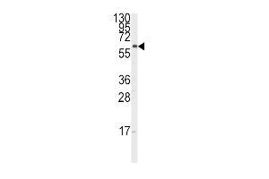 Western blot analysis of anti-CYP17A1 Antibody (Center) (ABIN392362 and ABIN2841999) in K562 cell line lysates (35 μg/lane). (CYP17A1 anticorps  (AA 358-388))