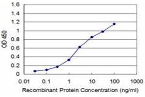 Detection limit for recombinant GST tagged PDK2 is approximately 0.