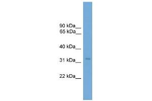 WB Suggested Anti-TCEA2 Antibody Titration: 0. (TCEA2 anticorps  (N-Term))