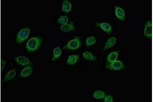 Immunofluorescent analysis of A549 cells using ABIN7144954 at dilution of 1:100 and Alexa Fluor 488-congugated AffiniPure Goat Anti-Rabbit IgG(H+L)
