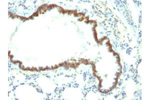 Formalin-fixed, paraffin-embedded Rat Lung stained with Ep-CAM Monoclonal Antibody (Epcam/1158). (EpCAM anticorps)