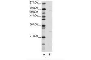 Image no. 2 for anti-Kelch-Like 13 (KLHL13) (N-Term) antibody (ABIN6736185) (KLHL13 anticorps  (N-Term))