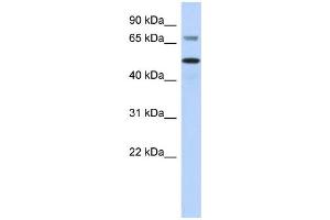 WB Suggested Anti-AKT2 Antibody Titration:  0. (AKT2 anticorps  (Middle Region))