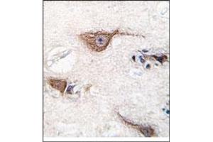 Image no. 1 for anti-Ubiquitin Carboxyl-terminal Esterase L1 (Ubiquitin Thiolesterase) (UCHL1) (N-Term) antibody (ABIN357509) (UCHL1 anticorps  (N-Term))