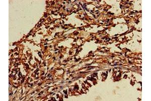 Immunohistochemistry of paraffin-embedded human lung tissue using ABIN7174052 at dilution of 1:100 (TYRO3 anticorps  (AA 728-873))
