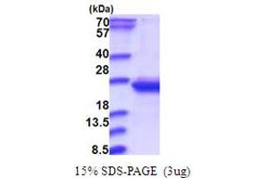 RWD Domain Containing 4 (RWDD4) (AA 1-188) protein (His tag)
